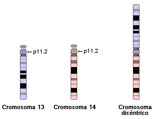 idiograma dicéntrico (13;14)