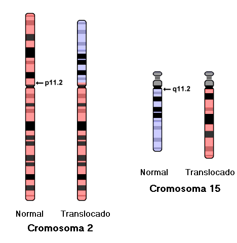 idiograma translocación 2;15)